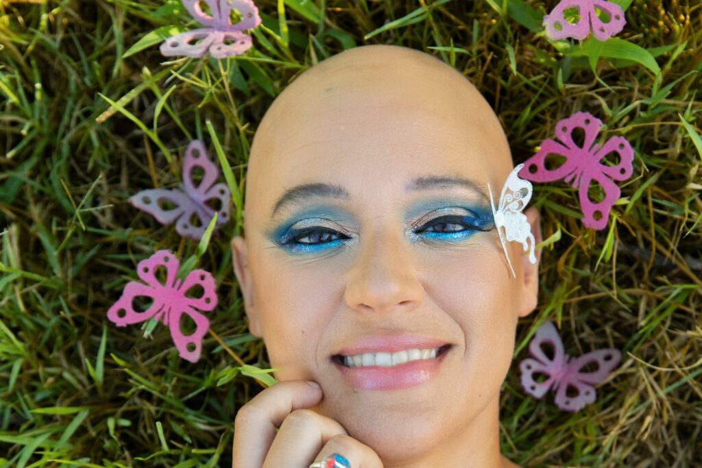 Alopecia femenina, Alopecia en las mujeres, Alopecia androgenética, alopecia areata, caída cabello mujer, siéntete bien con o sin pelo, aceptarme a mi misma con alopecia, fin alopecia femenina, no me siento sexy con alopecia, como ser tu misma con alopecia. no me gusto en el espejo con alopecia, miedo a que se rían de mi por mi alopecia